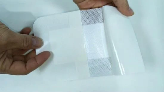 Mdr CE Approved Medical Adhesive Non-Woven Wound Dressingfor Hospital and Pharmacy with OEM